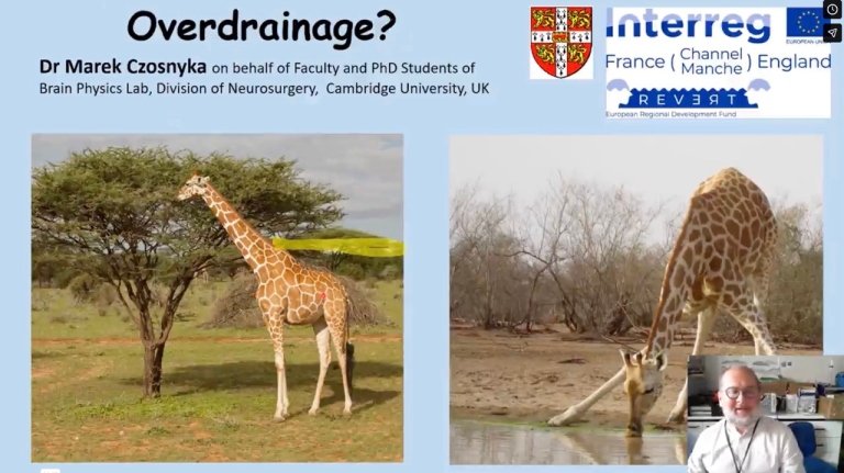Lecture 29: CSF Shunt Overdrainage