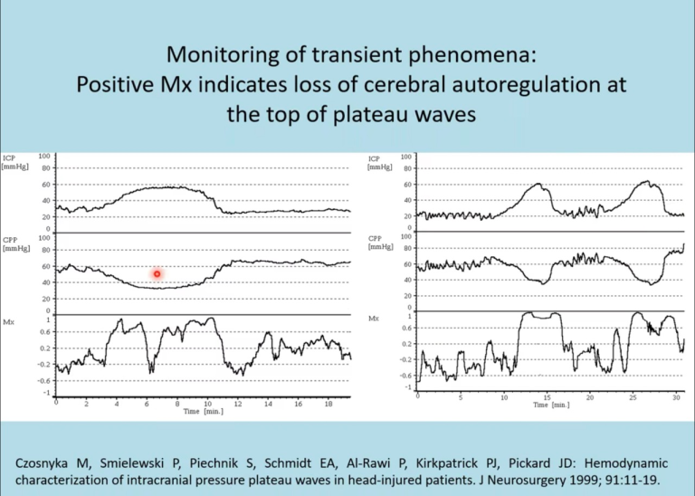 Lecture 18: Monitoring of Cerebral Autoregulation with Transcranial Doppler
