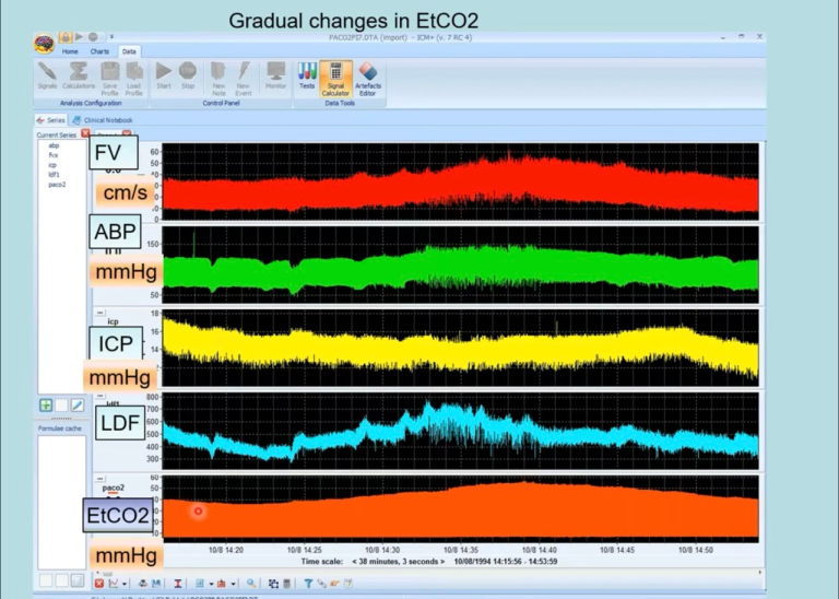 Lecture 26: Experimental Cerebrovascular Dynamics